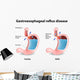 Gastroesophageal Reflux Disease Wall Decal