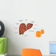 Alcohol Related Liver Disease Wall Decal