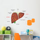 Alcohol Related Liver Disease Wall Decal