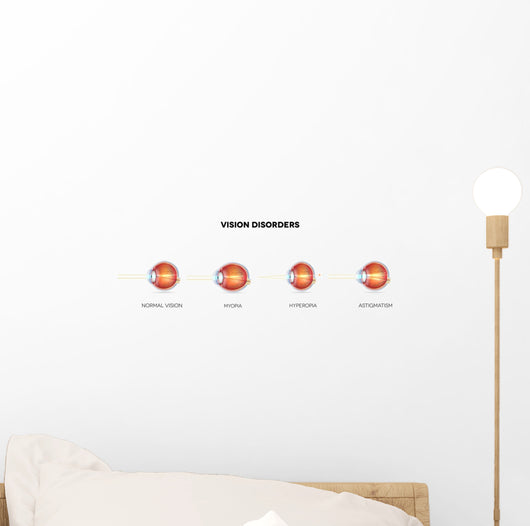 Eyesight Disorders Normal Eye Wall Decal