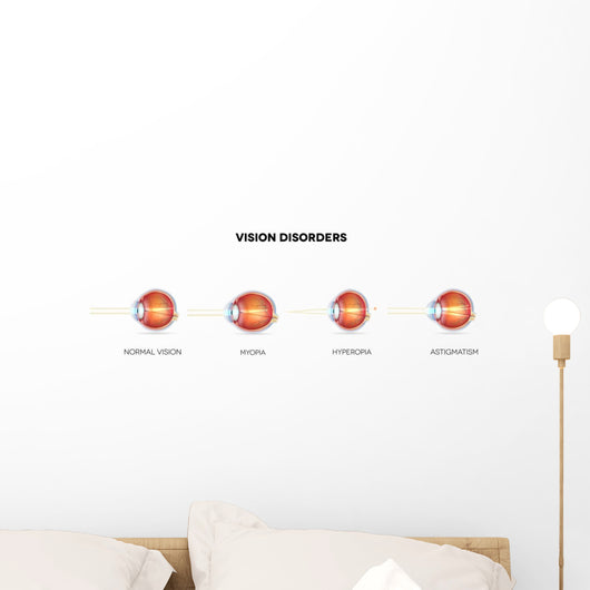 Eyesight Disorders Normal Eye Wall Decal