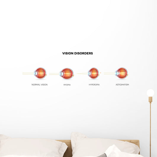 Eyesight Disorders Normal Eye Wall Decal