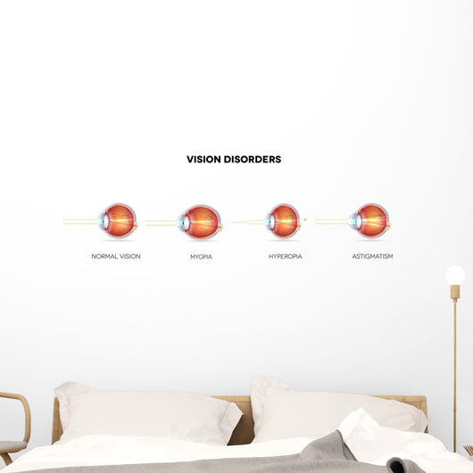 Eyesight Disorders Normal Eye Wall Decal