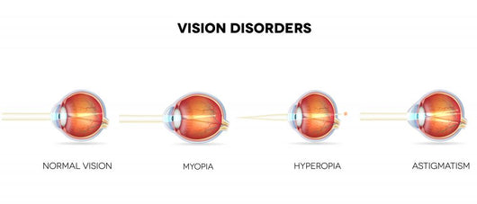 Eyesight Disorders Normal Eye Wall Decal