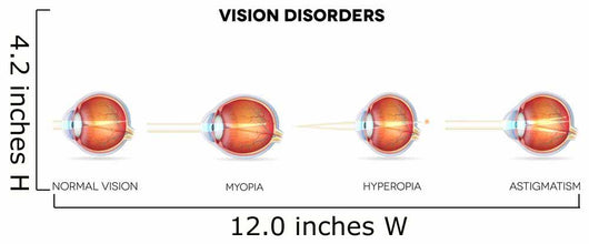 Eyesight Disorders Normal Eye Wall Decal