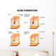 Acne Formation Wall Decal