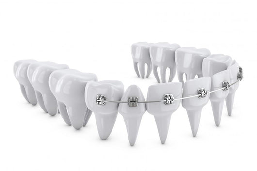 Dental Brackets Wall Decal