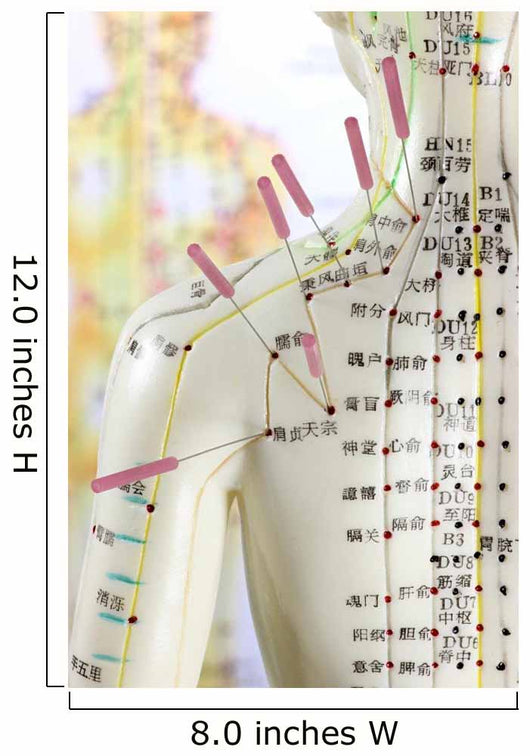 Acupuncture Model Wall Decal - WallMonkeys.com – Wallmonkeys