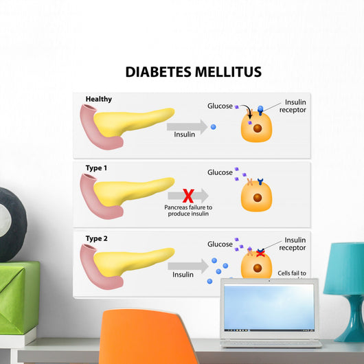 Diabetes Mellitus Wall Decal