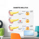 Diabetes Mellitus Wall Decal