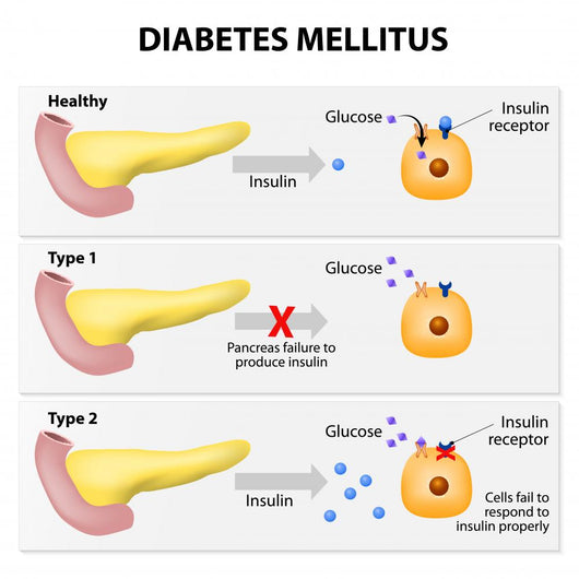 Diabetes Mellitus Wall Decal