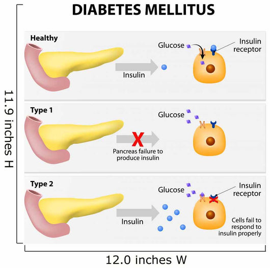 Diabetes Mellitus Wall Decal
