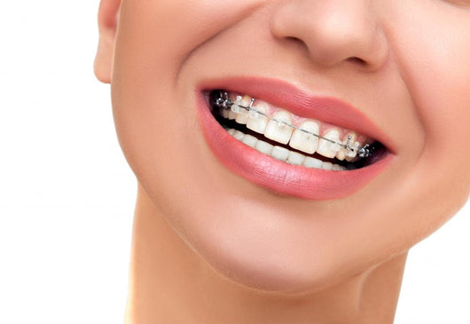 Closeup Beautiful Female Smile Wall Decal