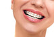 Closeup Beautiful Female Smile Wall Decal