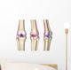 Knee Joint Anatomy Wall Decal