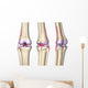 Knee Joint Anatomy Wall Decal