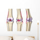 Knee Joint Anatomy Wall Decal