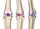 Knee Joint Anatomy Wall Decal