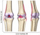 Knee Joint Anatomy Wall Decal