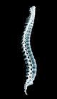 Human Spine Black Xray Wall Decal