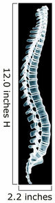 Human Spine Black Xray Wall Decal