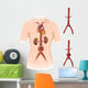 Artist Depiction Abdominal Aortic Wall Decal Design 2