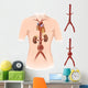 Artist Depiction Abdominal Aortic Wall Decal Design 2