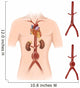 Artist Depiction Abdominal Aortic Wall Decal Design 2