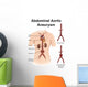 Artist Depiction Abdominal Aortic Wall Decal Design 1