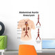 Artist Depiction Abdominal Aortic Wall Decal Design 1