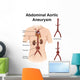 Artist Depiction Abdominal Aortic Wall Decal Design 1