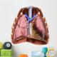 Artist Depiction Mesothelioma Lungs Wall Decal
