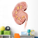 Cross Section Human Kidney Wall Decal