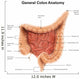 General Colon Anatomy with Wall Decal Design 1