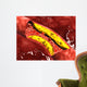 Microscopic Fat Plaque inside Wall Decal