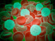 Sickle Cell Anemia with Wall Decal