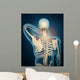 Medical Illustration Showing Inflammation Wall Decal Design 3