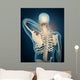 Medical Illustration Showing Inflammation Wall Decal Design 3