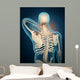 Medical Illustration Showing Inflammation Wall Decal Design 3