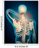 Medical Illustration Showing Inflammation Wall Decal Design 3