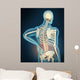 Medical Illustration Showing Inflammation Wall Decal Design 2
