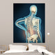 Medical Illustration Showing Inflammation Wall Decal Design 2