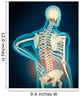 Medical Illustration Showing Inflammation Wall Decal Design 2