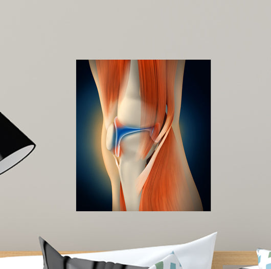Medical Illustration Showing Inflammation Wall Decal Design 1
