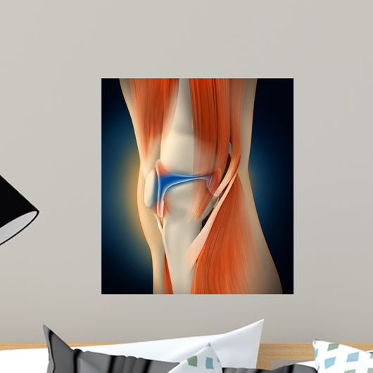 Medical Illustration Showing Inflammation Wall Decal Design 1