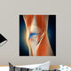Medical Illustration Showing Inflammation Wall Decal Design 1