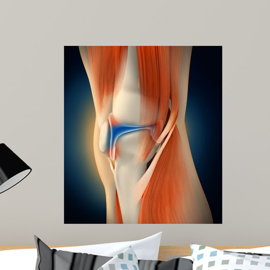 Medical Illustration Showing Inflammation Wall Decal Design 1