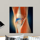 Medical Illustration Showing Inflammation Wall Decal Design 1