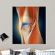 Medical Illustration Showing Inflammation Wall Decal Design 1