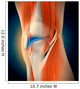 Medical Illustration Showing Inflammation Wall Decal Design 1
